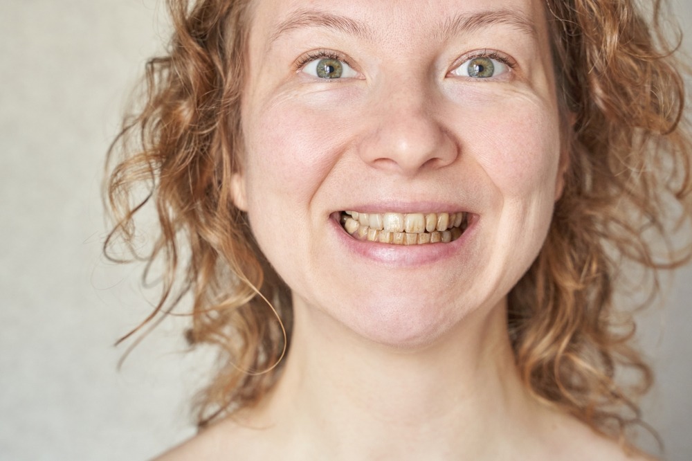 what happens if you never get a dental cleaning