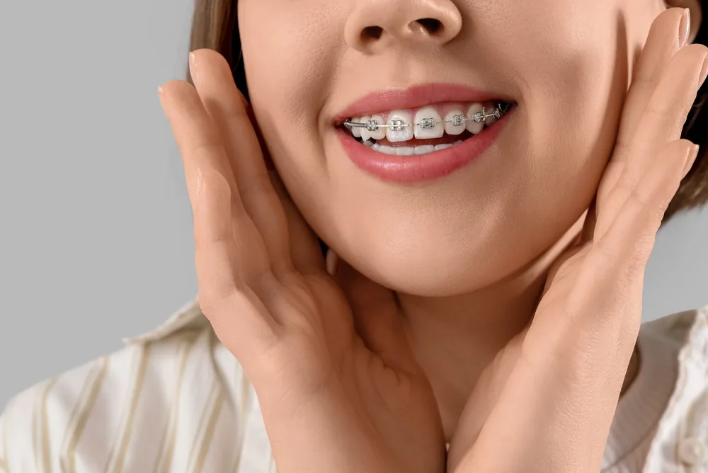 Smiling woman with metal braces on her teeth, holding her hands to her cheeks